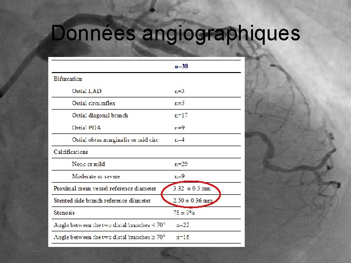 Données angiographiques 