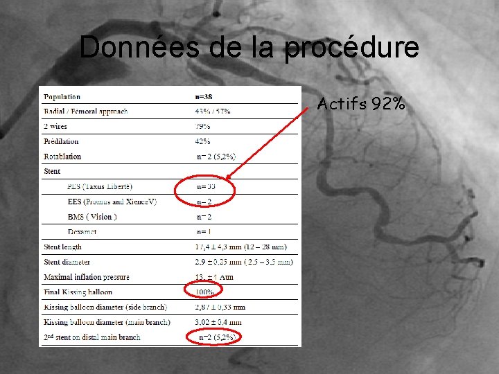 Données de la procédure Actifs 92% 