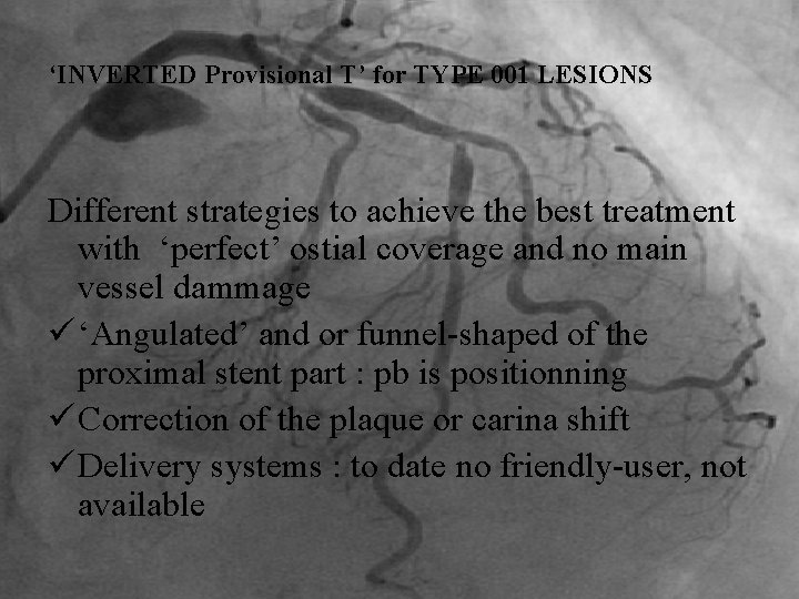 ‘INVERTED Provisional T’ for TYPE 001 LESIONS Different strategies to achieve the best treatment
