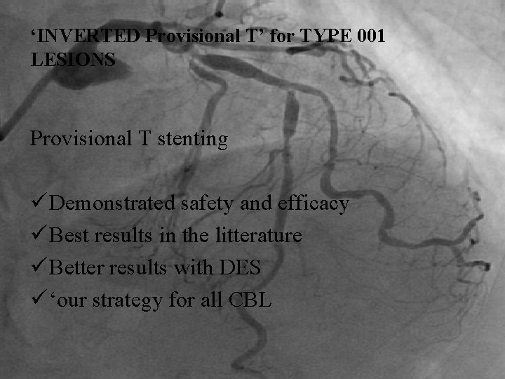 ‘INVERTED Provisional T’ for TYPE 001 LESIONS Provisional T stenting ü Demonstrated safety and