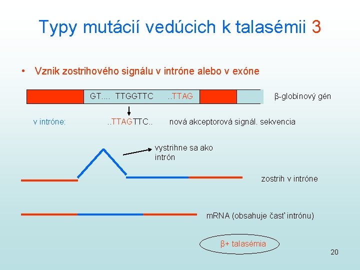 Typy mutácií vedúcich k talasémii 3 • Vznik zostrihového signálu v intróne alebo v