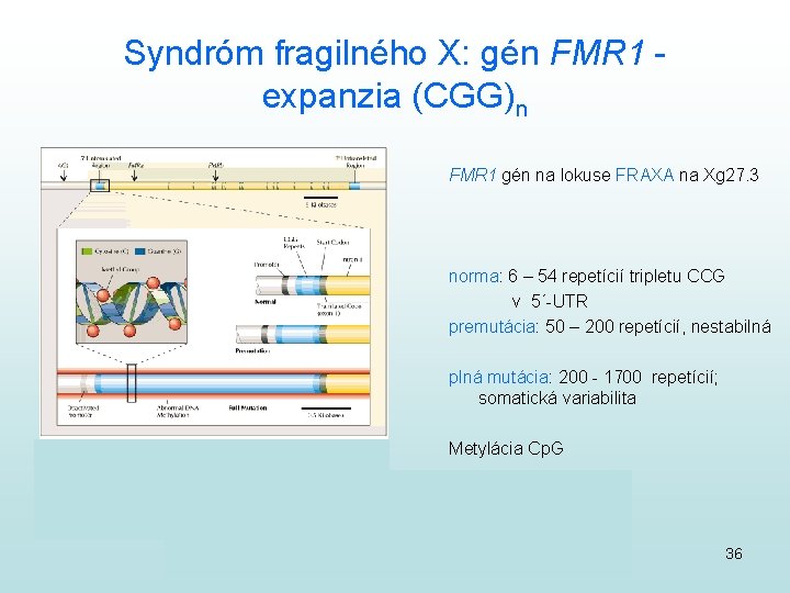 Syndróm fragilného X: gén FMR 1 expanzia (CGG)n FMR 1 gén na lokuse FRAXA