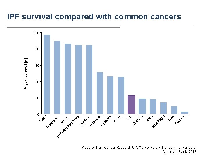 IPF survival compared with common cancers 100 60 40 as nc re g Pa