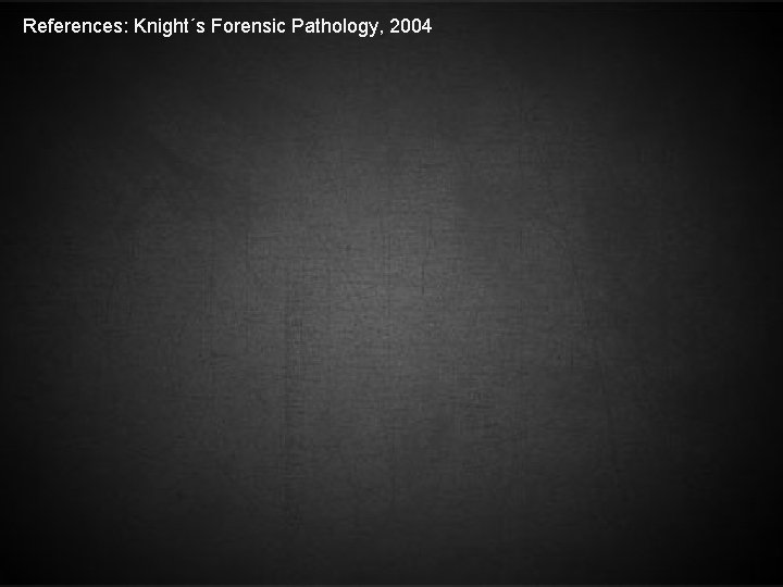 References: Knight´s Forensic Pathology, 2004 