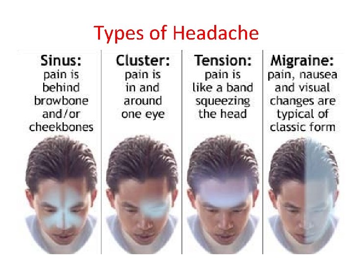 Types of Headache 