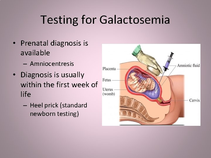 Testing for Galactosemia • Prenatal diagnosis is available – Amniocentresis • Diagnosis is usually
