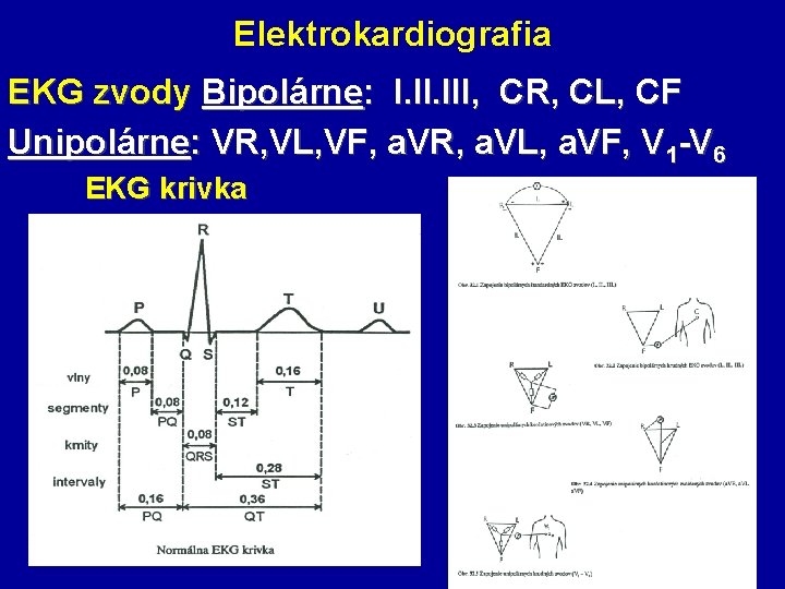 Elektrokardiografia EKG zvody Bipolárne: I. III, CR, CL, CF Unipolárne: VR, VL, VF, a.
