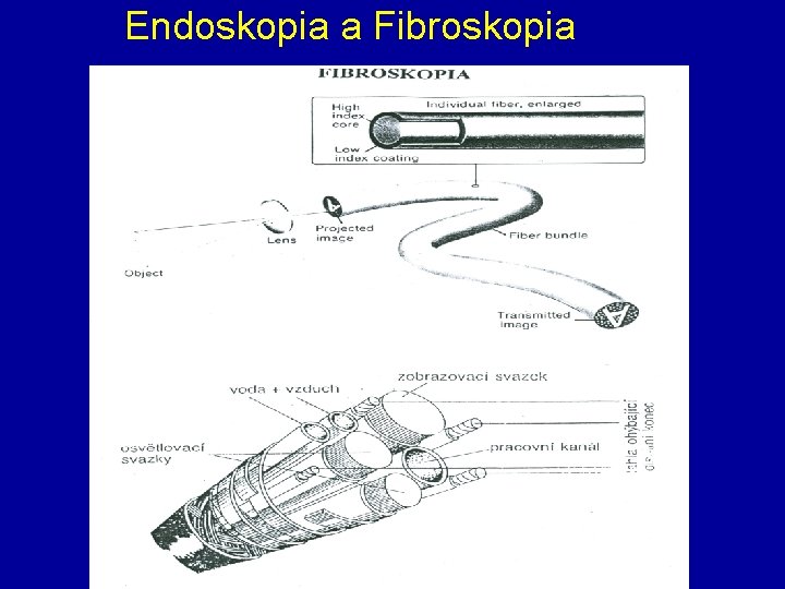 Endoskopia a Fibroskopia 