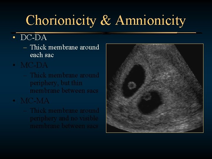 Chorionicity & Amnionicity • DC-DA – Thick membrane around each sac • MC-DA –