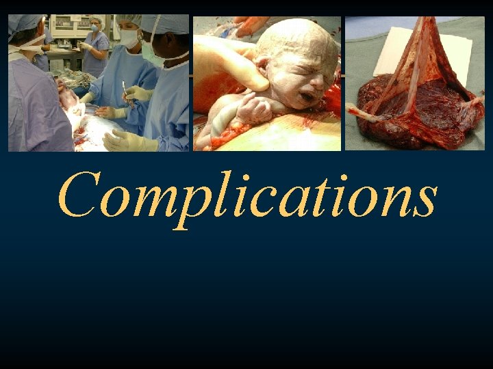 Complications 