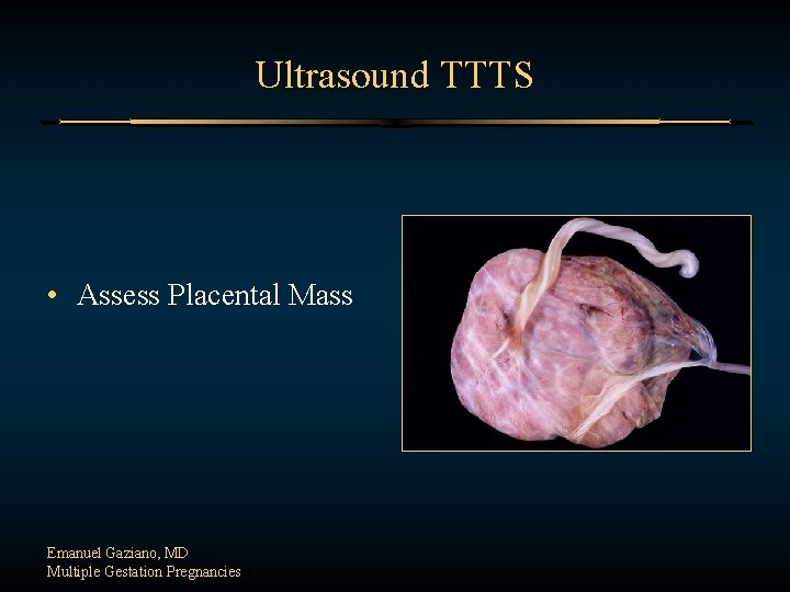 Ultrasound TTTS • Assess Placental Mass Emanuel Gaziano, MD Multiple Gestation Pregnancies 