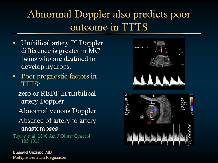 Abnormal Doppler also predicts poor outcome in TTTS • Umbilical artery PI Doppler difference
