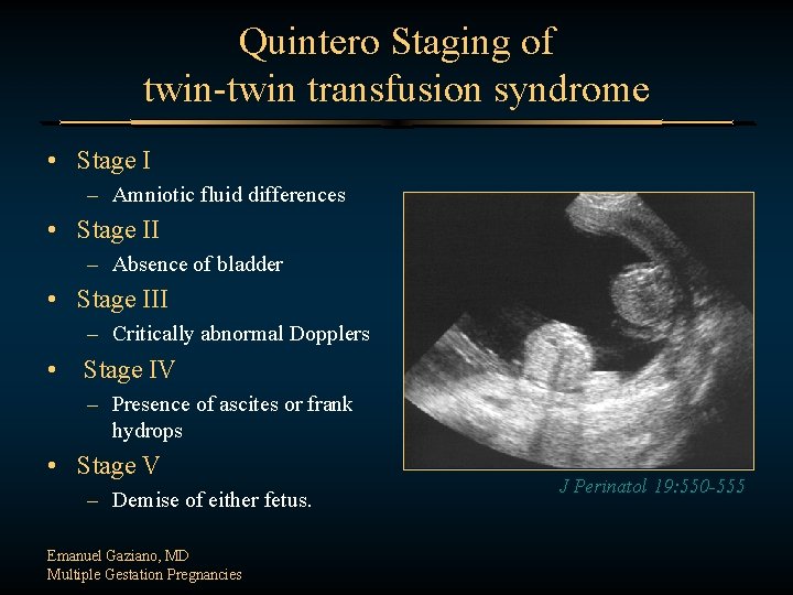 Quintero Staging of twin-twin transfusion syndrome • Stage I – Amniotic fluid differences •