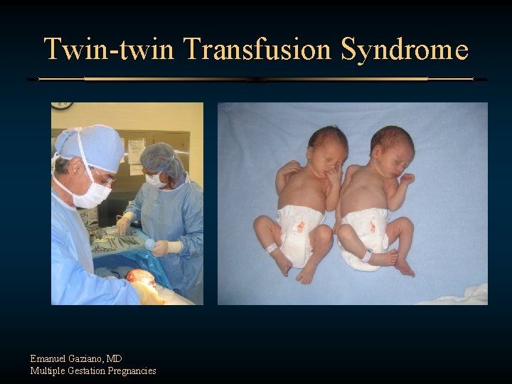 Twin-twin Transfusion Syndrome Emanuel Gaziano, MD Multiple Gestation Pregnancies 