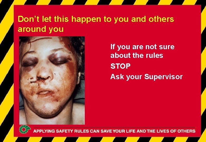 Don’t let this happen to you and others around you If you are not Don’t let this happen to you and others around you If you are not