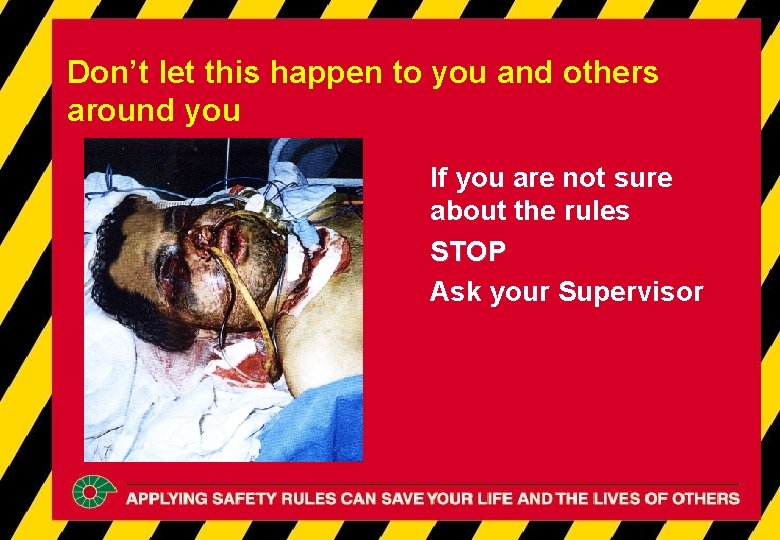 Don’t let this happen to you and others around you If you are not Don’t let this happen to you and others around you If you are not