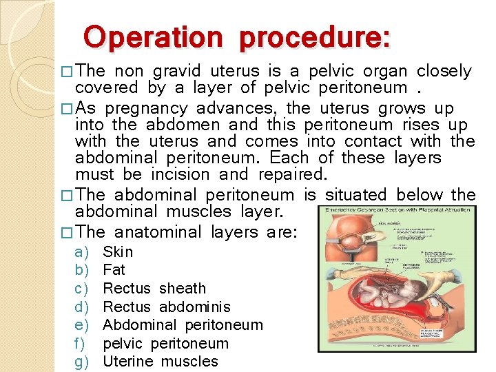 Operation procedure: � The non gravid uterus is a pelvic organ closely covered by