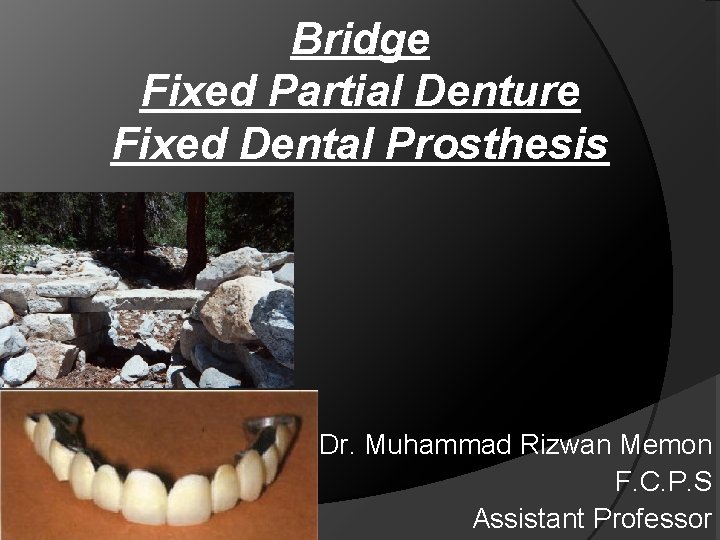Bridge Fixed Partial Denture Fixed Dental Prosthesis Dr. Muhammad Rizwan Memon F. C. P.