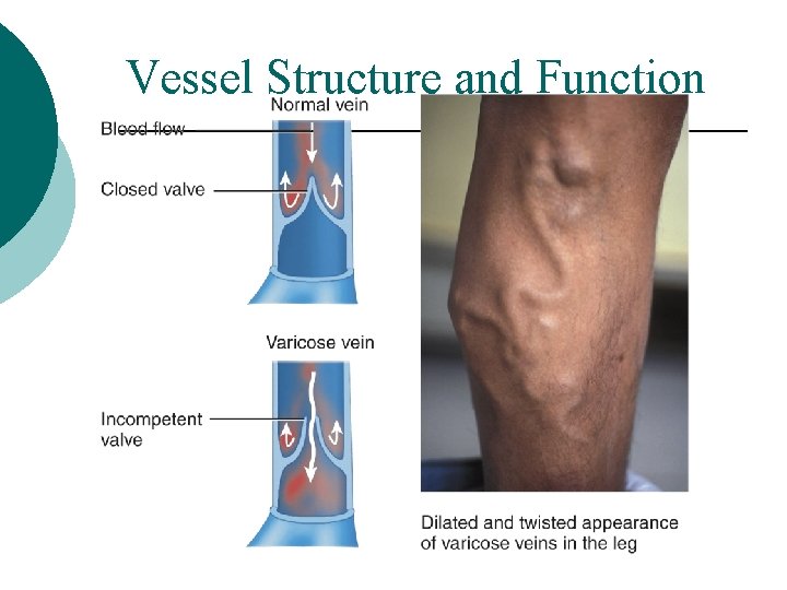 Vessel Structure and Function 