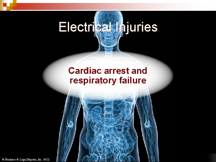 Injuries Electrical from Electric Shock n n n Electrocution Electrical burns Muscle, Cardiac Secondary