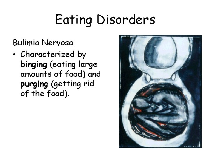 Eating Disorders Bulimia Nervosa • Characterized by binging (eating large amounts of food) and