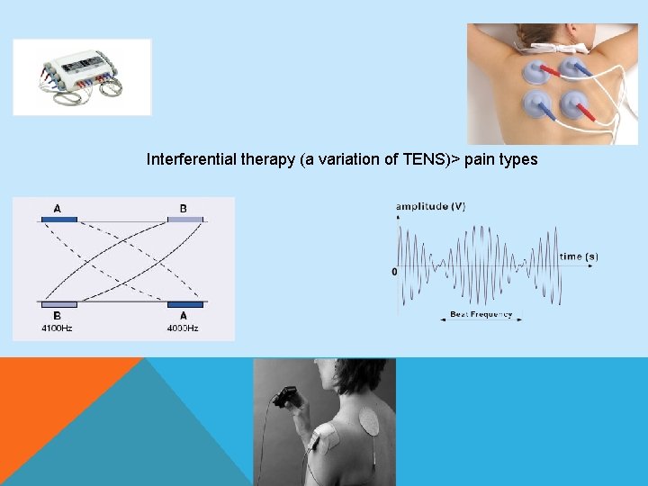 Interferential therapy (a variation of TENS)> pain types 