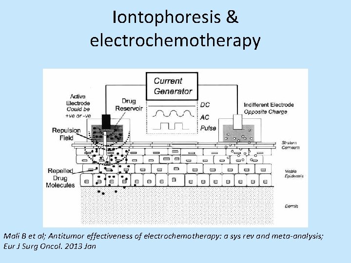 Iontophoresis & electrochemotherapy Mali B et al; Antitumor effectiveness of electrochemotherapy: a sys rev