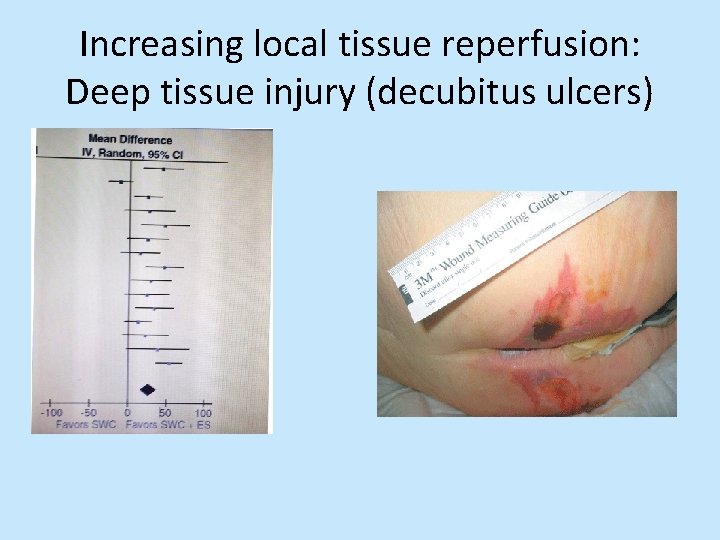 Increasing local tissue reperfusion: Deep tissue injury (decubitus ulcers) 