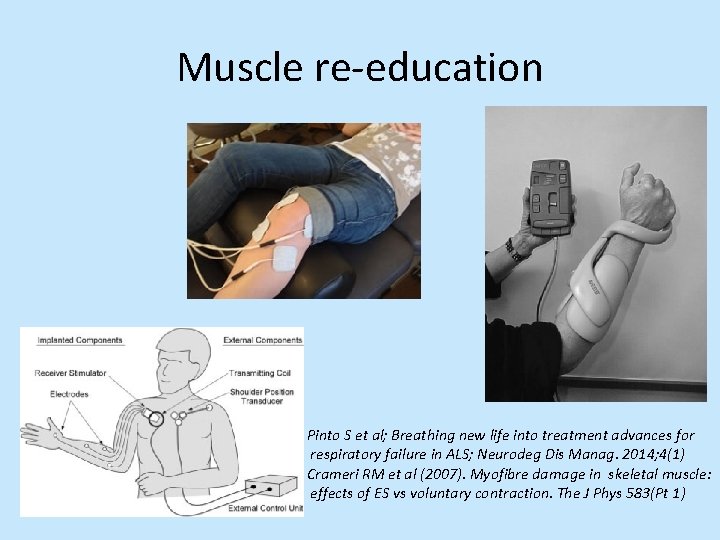 Muscle re-education Pinto S et al; Breathing new life into treatment advances for respiratory