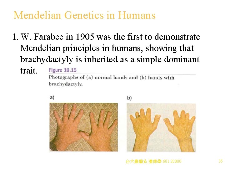 Mendelian Genetics in Humans 1. W. Farabee in 1905 was the first to demonstrate