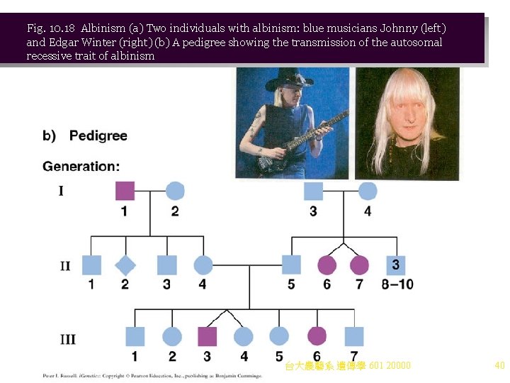 Fig. 10. 18 Albinism (a) Two individuals with albinism: blue musicians Johnny (left) and