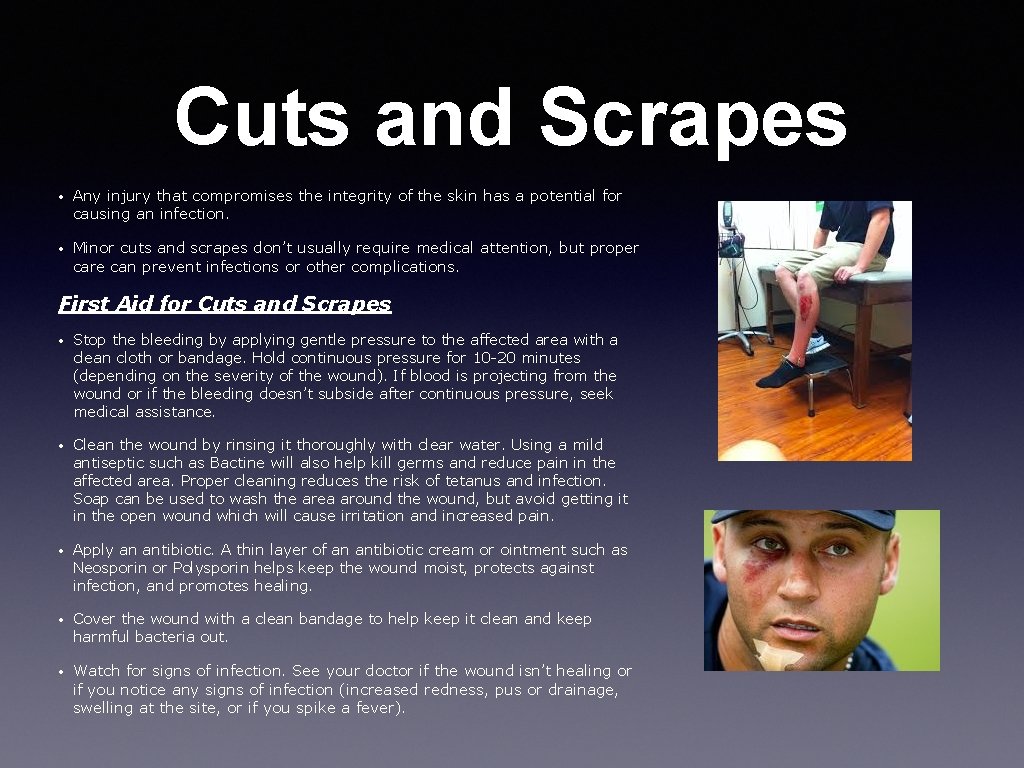 Cuts and Scrapes • Any injury that compromises the integrity of the skin has