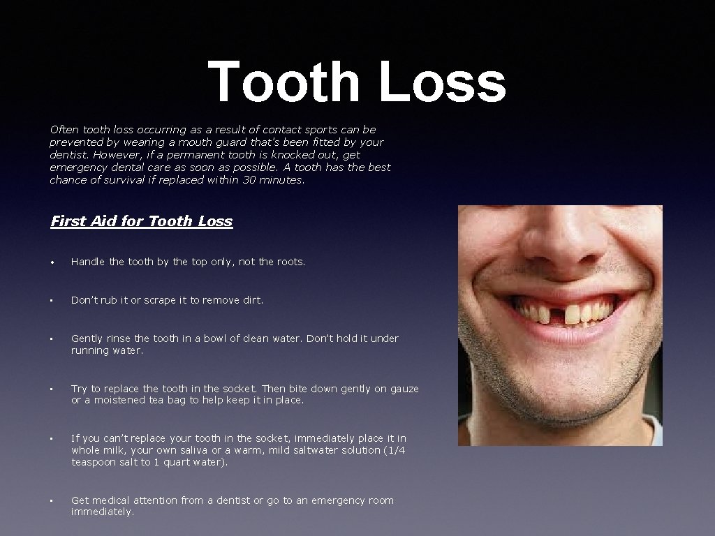 Tooth Loss Often tooth loss occurring as a result of contact sports can be
