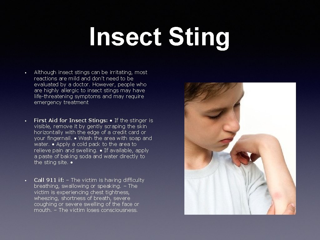 Insect Sting • Although insect stings can be irritating, most reactions are mild and