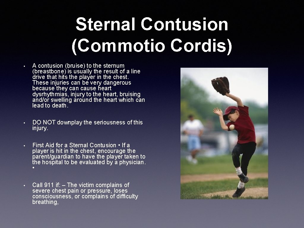 Sternal Contusion (Commotio Cordis) • A contusion (bruise) to the sternum (breastbone) is usually