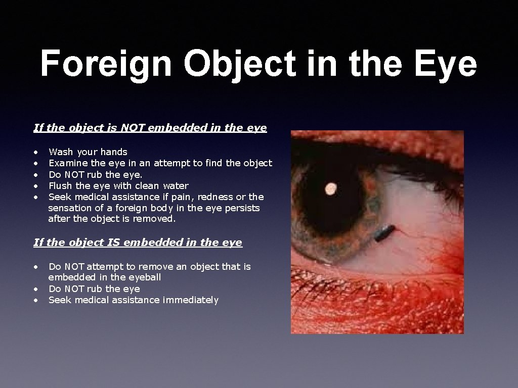 Foreign Object in the Eye If the object is NOT embedded in the eye