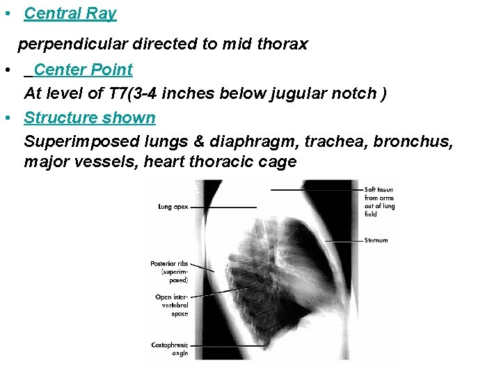  • Central Ray perpendicular directed to mid thorax • Center Point At level