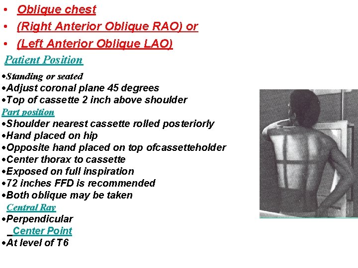  • Oblique chest • (Right Anterior Oblique RAO) or • (Left Anterior Oblique