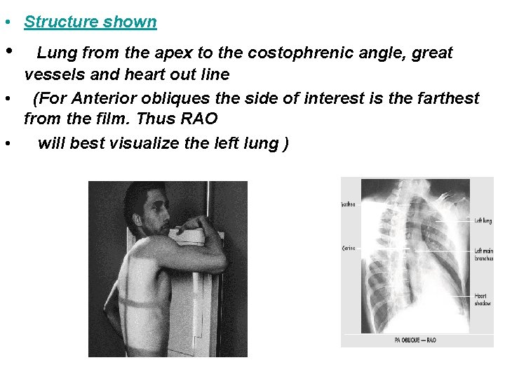  • Structure shown • Lung from the apex to the costophrenic angle, great