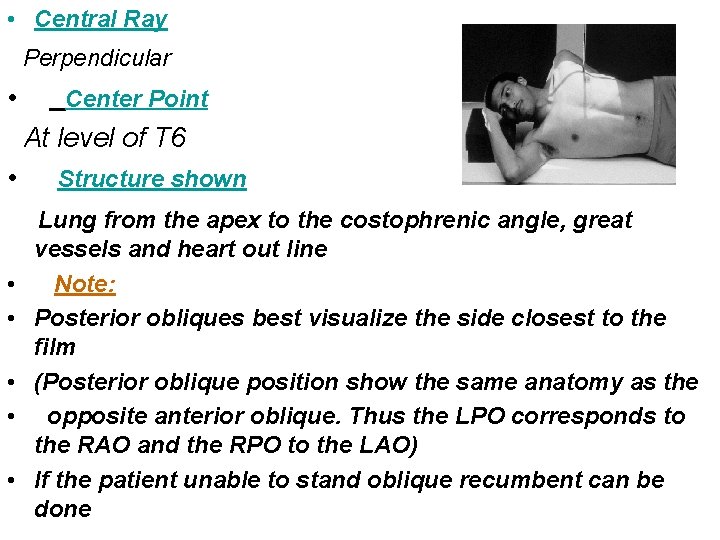  • Central Ray Perpendicular • Center Point At level of T 6 •