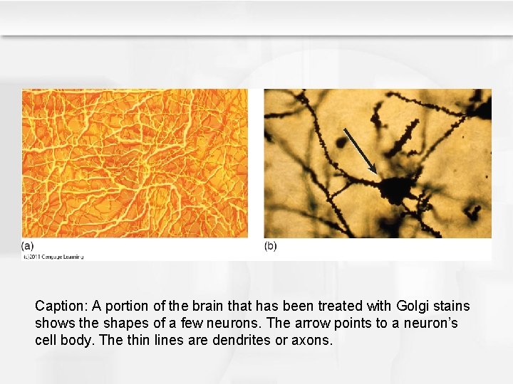 Caption: A portion of the brain that has been treated with Golgi stains shows