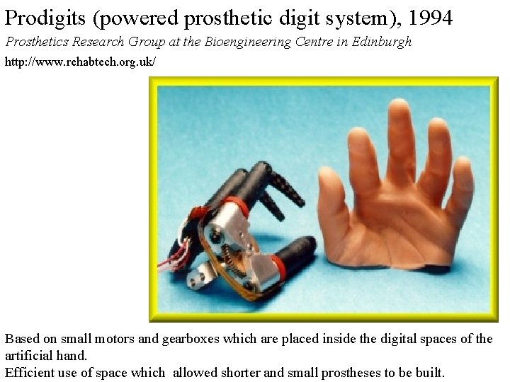 Prodigits (powered prosthetic digit system), 1994 Prosthetics Research Group at the Bioengineering Centre in Prodigits (powered prosthetic digit system), 1994 Prosthetics Research Group at the Bioengineering Centre in