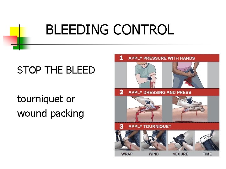 BLEEDING CONTROL STOP THE BLEED tourniquet or wound packing 