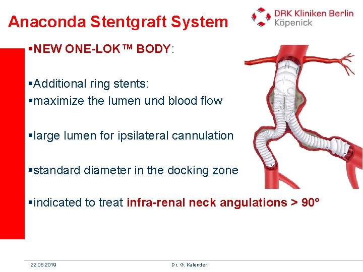 Anaconda Stentgraft System §NEW ONE-LOK™ BODY: §Additional ring stents: §maximize the lumen und blood