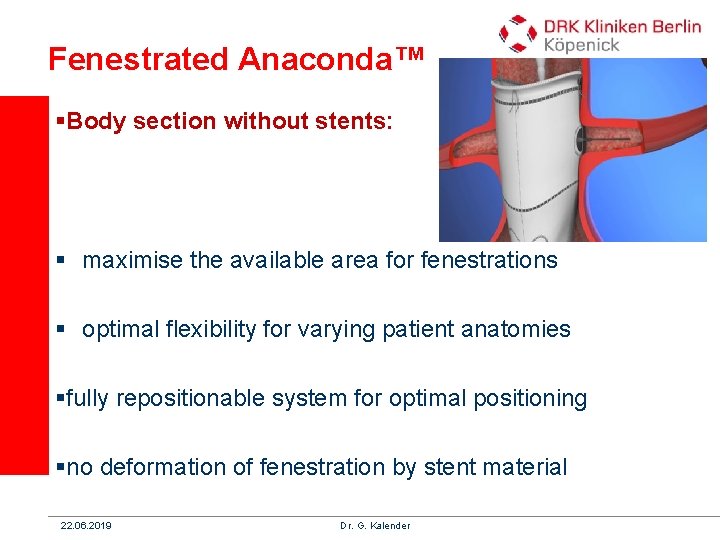 Fenestrated Anaconda™ §Body section without stents: § maximise the available area for fenestrations §