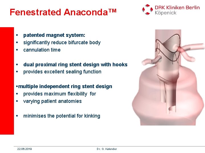 Fenestrated Anaconda™ § § § patented magnet system: significantly reduce bifurcate body cannulation time