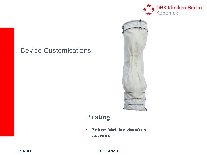 Device Customisations Pleating • 22. 06. 2019 Reduces fabric in region of aortic narrowing