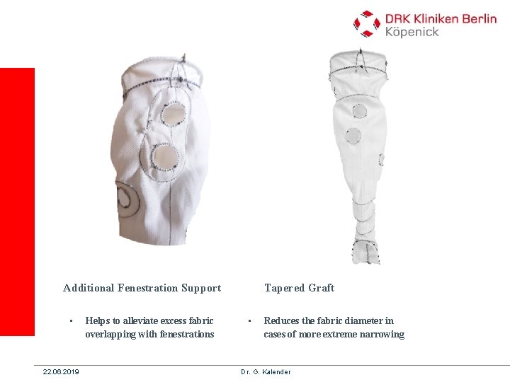 Additional Fenestration Support • 22. 06. 2019 Helps to alleviate excess fabric overlapping with