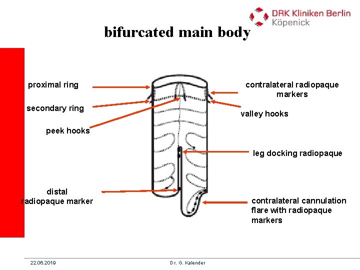 bifurcated main body proximal ring contralateral radiopaque markers secondary ring valley hooks peek hooks bifurcated main body proximal ring contralateral radiopaque markers secondary ring valley hooks peek hooks