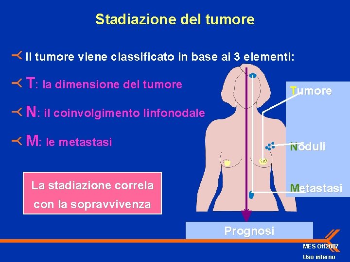 Stadiazione del tumore Il tumore viene classificato in base ai 3 elementi: T: la